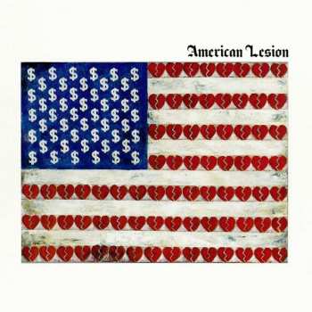 LP American Lesion: American Lesion