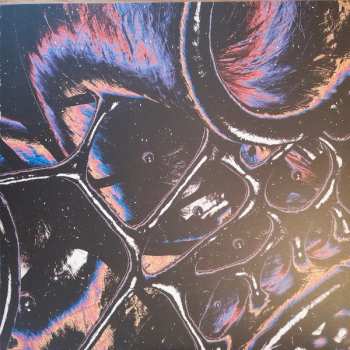 LP AUA: The Damaged Organ