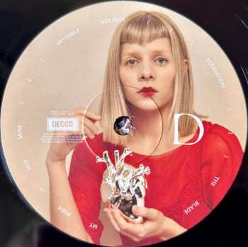 2LP Aurora: What Happened To The Heart?