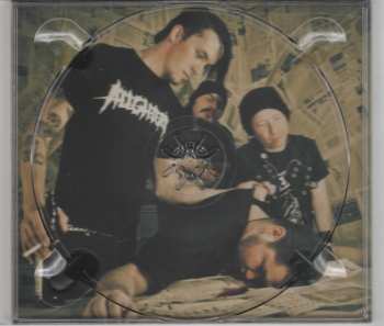 CD Beneath the Cellar: Lesions