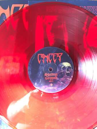 LP Cancer: Shadow Gripped LTD
