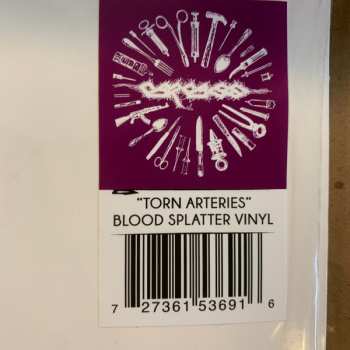 2LP Carcass: Torn Arteries CLR