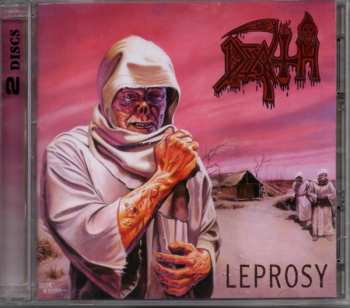 2CD Death: Leprosy