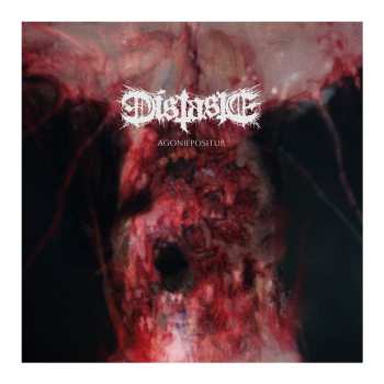 Album Distaste: Agoniepositur