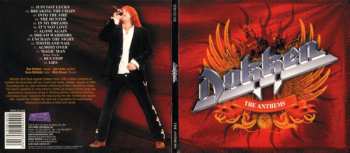 CD Dokken: The Anthems