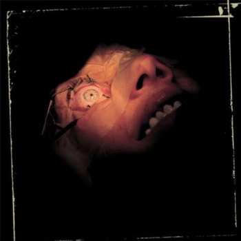 CD Exhumed: Anatomy Is Destiny
