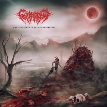 CD Gutrectomy: Manifestation Of Human Suffering