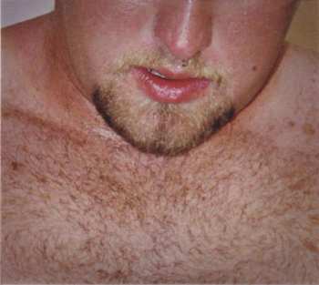CD Hirsute Pursuit: Tighten That Muscle Ring