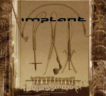 2CD Implant: Implantology + Surgical Files