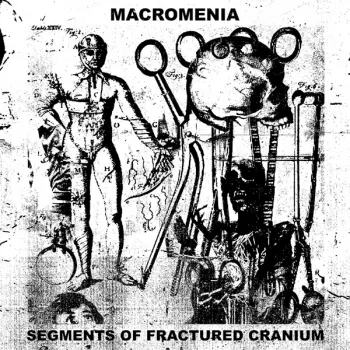 Segments Of Fractured Cranium