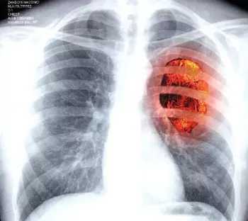 L'Estinzione Di Un Colloquio Amoroso