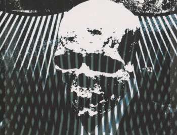 CD Nephrectomy: No Lives Matter