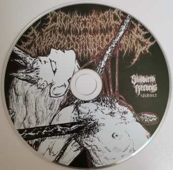 CD Onchocerciasis Esophagogastroduodenoscopy: The Fallen Lament