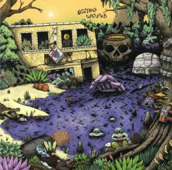 CD Oozing Wound: High Anxiety