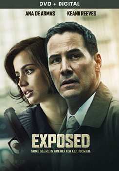 DVD Orchiopexy: Exposed