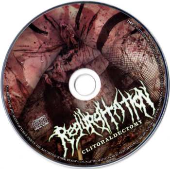 CD Regurgitation: Clitoraldectomy