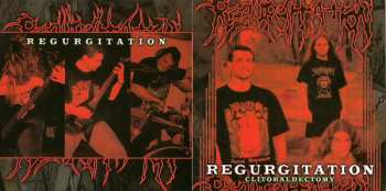 CD Regurgitation: Clitoraldectomy