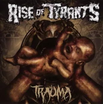 Trauma