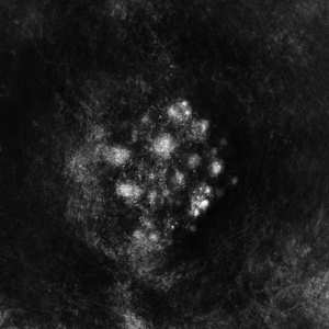 Album Saffronkeira: Synecdoche