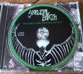 CD Skeletal Earth: Eulogy For A Dying Fetus