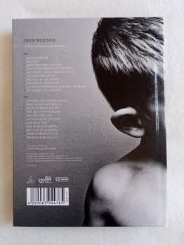 2CD Spiritual Front: Open Wounds LTD