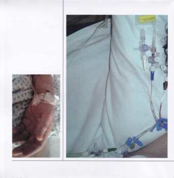 CD Spiritualized: Songs In A&E