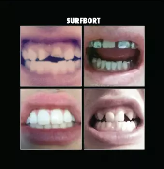 Surfbort: Surfbort