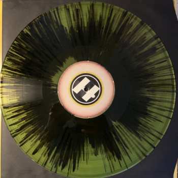 LP Unglued: Total XTC