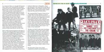 4CD/Box Set Zior: Before My Eyes Go Blind: The Complete Recordings